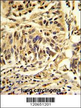 CEBPB Antibody