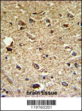 CCRN4L Antibody