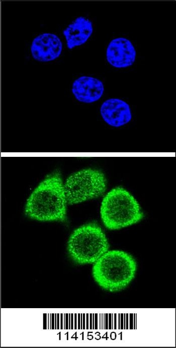 PARP1 Antibody