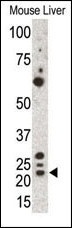 Grem1 Antibody