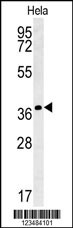 IL24 Antibody