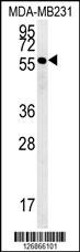 RAB11FIP2 Antibody