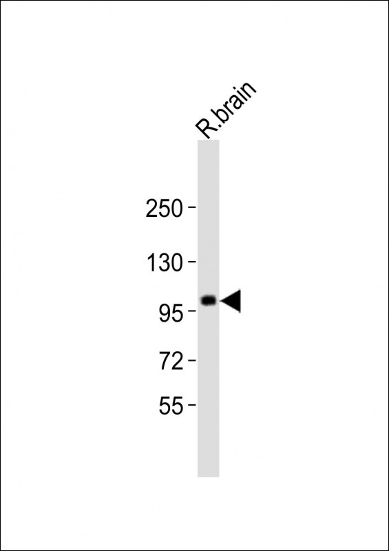 ST18 Antibody