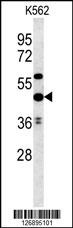 UBAC1 Antibody