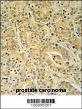 UBAC1 Antibody