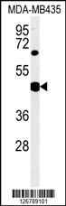 SH2D2A Antibody
