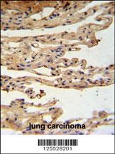 FKBPL Antibody