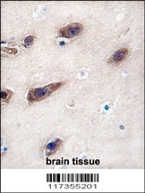 STX3 Antibody