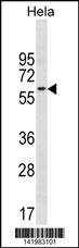 CD3EAP Antibody