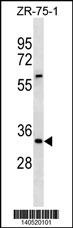 ING2 Antibody