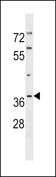 TP53I3 Antibody