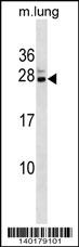 Cbx5 Antibody