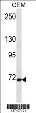 FZD3 Antibody