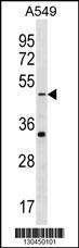 GABRR2 Antibody