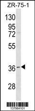 RNF144B Antibody