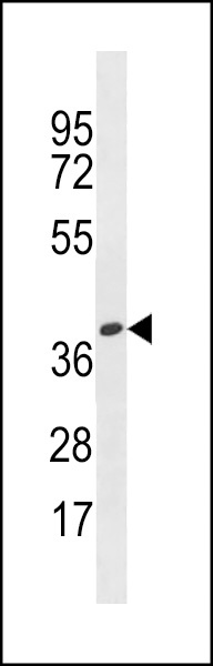 OR4X1 Antibody