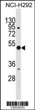 ANXA10 Antibody