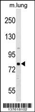 RHPN1 Antibody