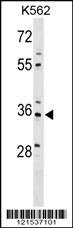 PDLIM4 Antibody