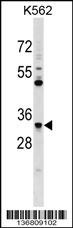 FCN1 Antibody