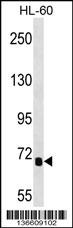 IL1RAPL2 Antibody