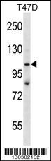 TP53BP2 Antibody