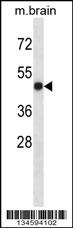LTBR Antibody