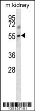 Tgfbr1 Antibody
