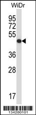 UQCRC2 Antibody