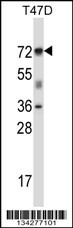 FOXK2 Antibody