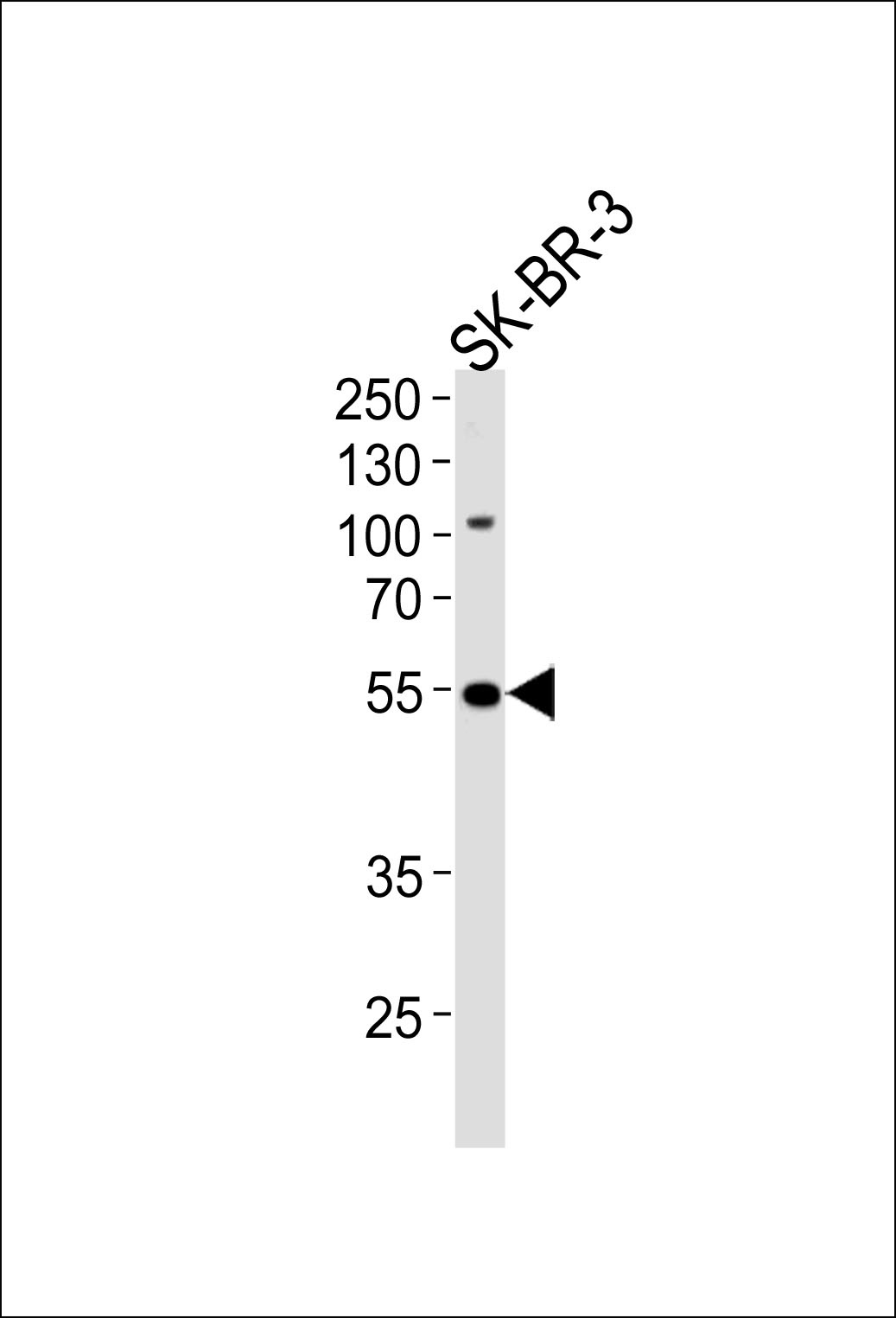 SMARCE1 Antibody