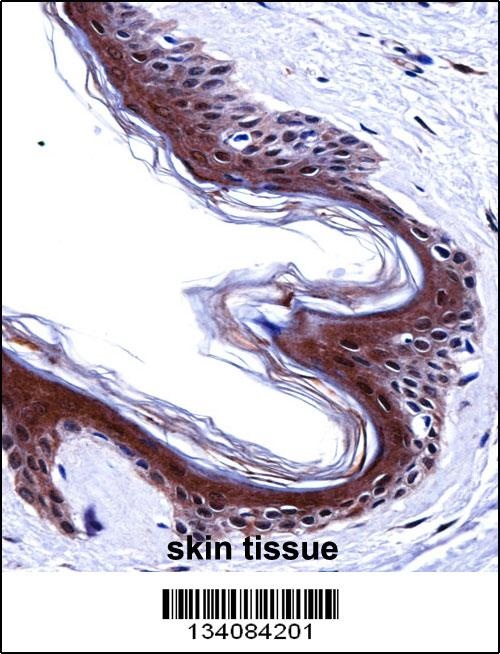 SMARCE1 Antibody