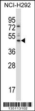 TEAD3 Antibody