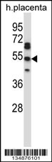 TEAD2 Antibody