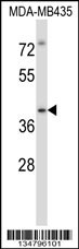 Irak4 Antibody