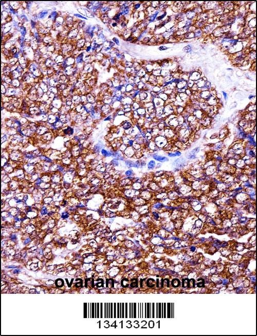 BAG2 Antibody