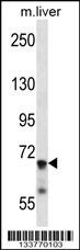 IL1R1 Antibody