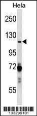 PARP1 Antibody