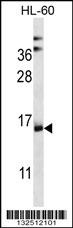 NDUFAF4 Antibody