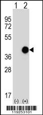 CTSK Antibody