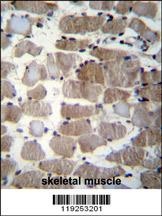 CTSK Antibody