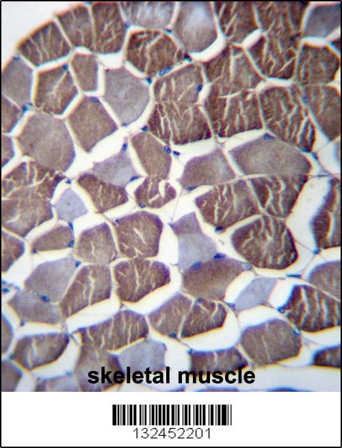 NPHP3 Antibody