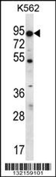 ABCD2 Antibody