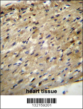 ABCD2 Antibody