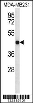 TMEM43 Antibody