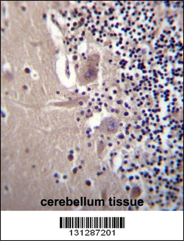 CRYBA1 Antibody