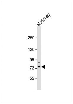 Tiparp Antibody