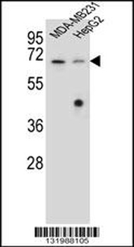 GLMN Antibody