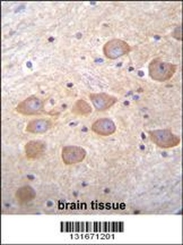 PCDH1 Antibody