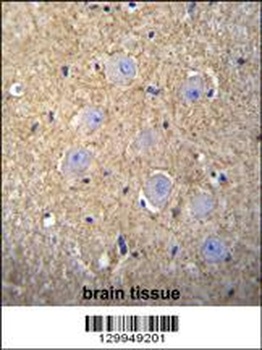 OR2T3 Antibody